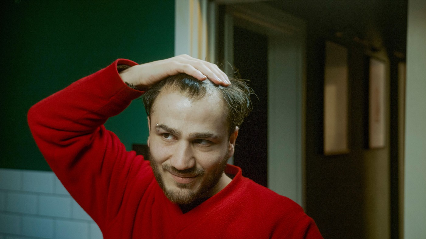 Man applying hair loss serum looking stressed worried about thinning hair and hair health using treatment in daily grooming routine