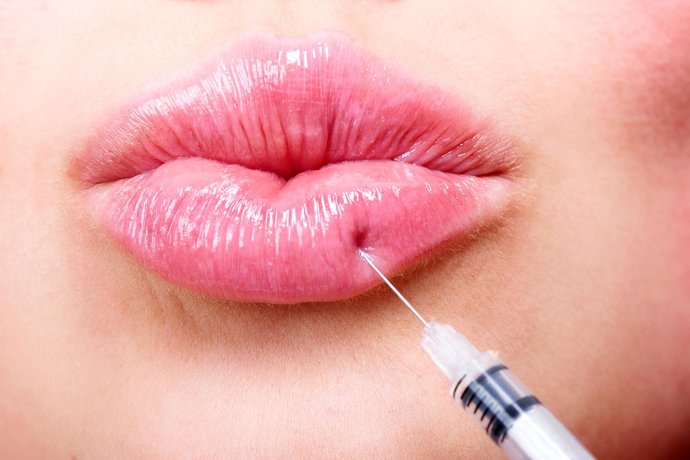 Closeup shot of beautiful young woman receiving filler injection in lips, beauty treatment concept