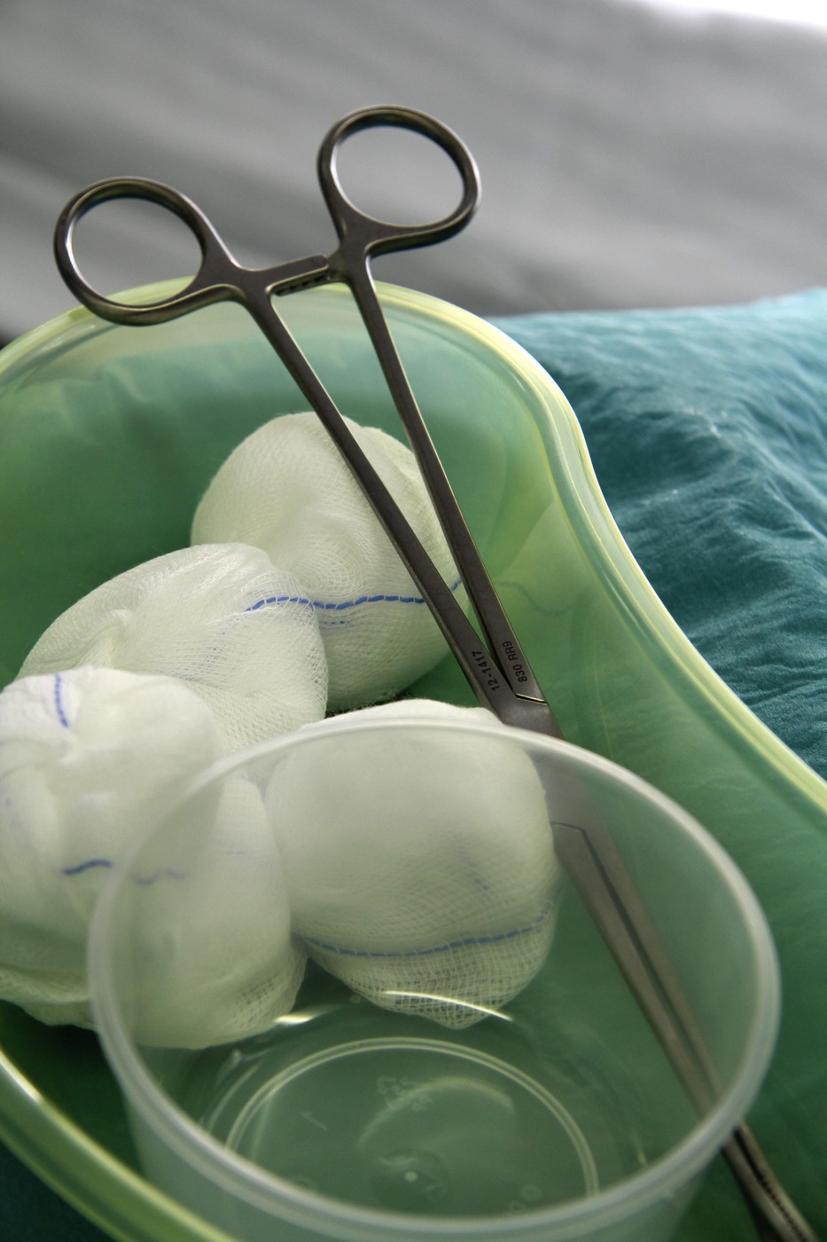 Zdravniki niso verjeli, kaj so odkrili v trebuhu deklice