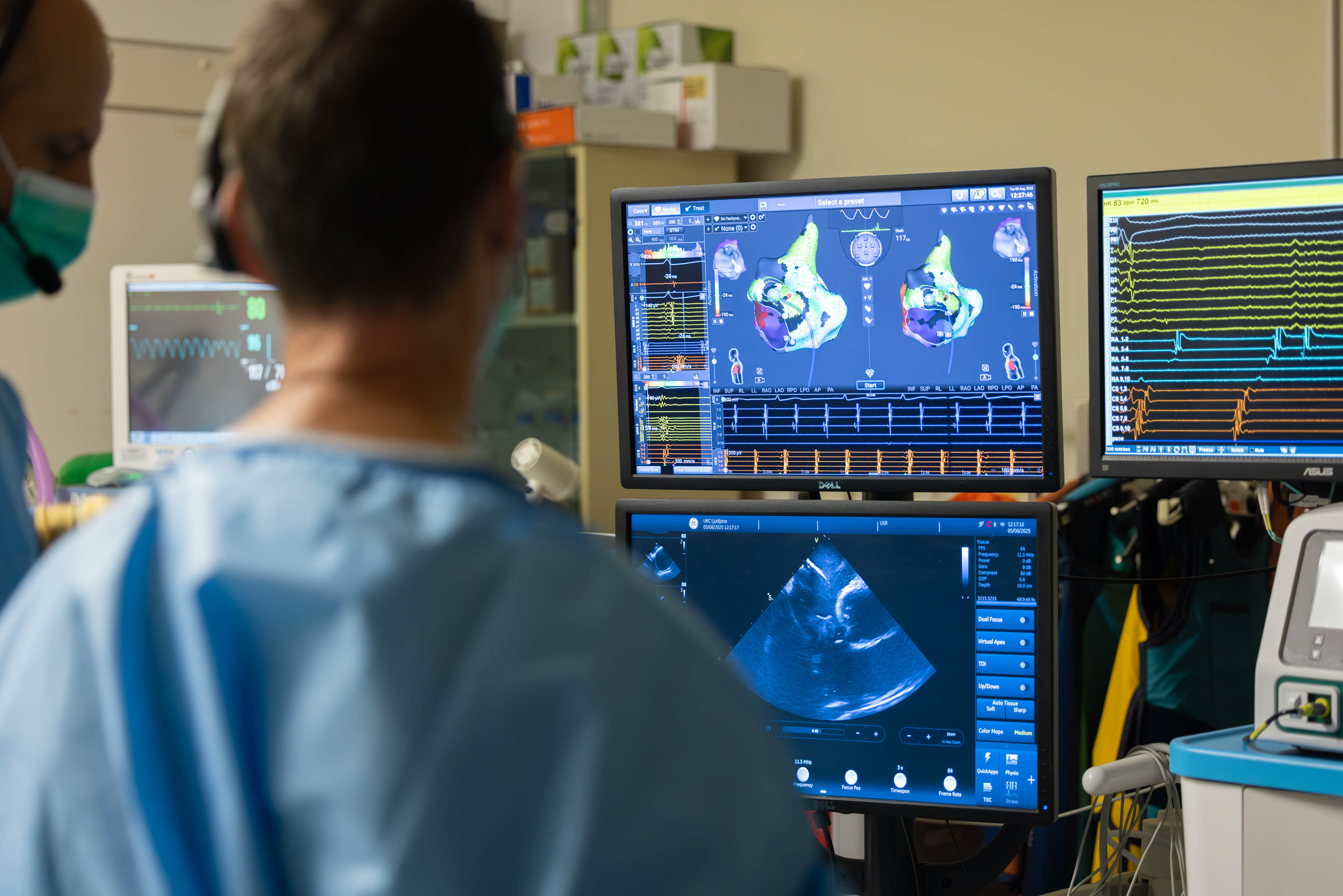 V Univerzitetnem kliničnem centru (UKC) Ljubljana so pridobili najsodobnejšo napravo za zdravljenje kompleksnih motenj srčnega ritma.