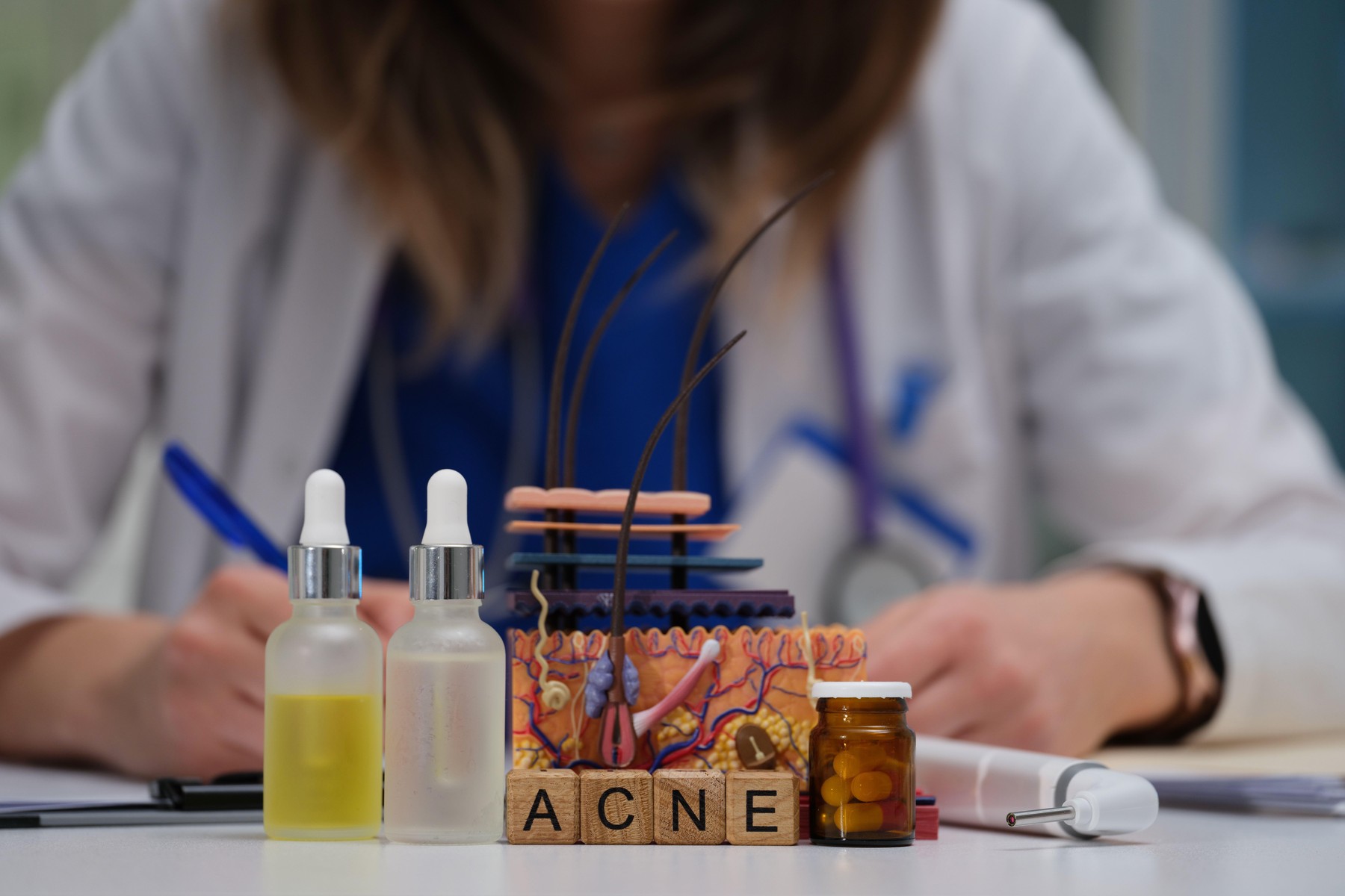 Dermatologinja svetuje glede aken