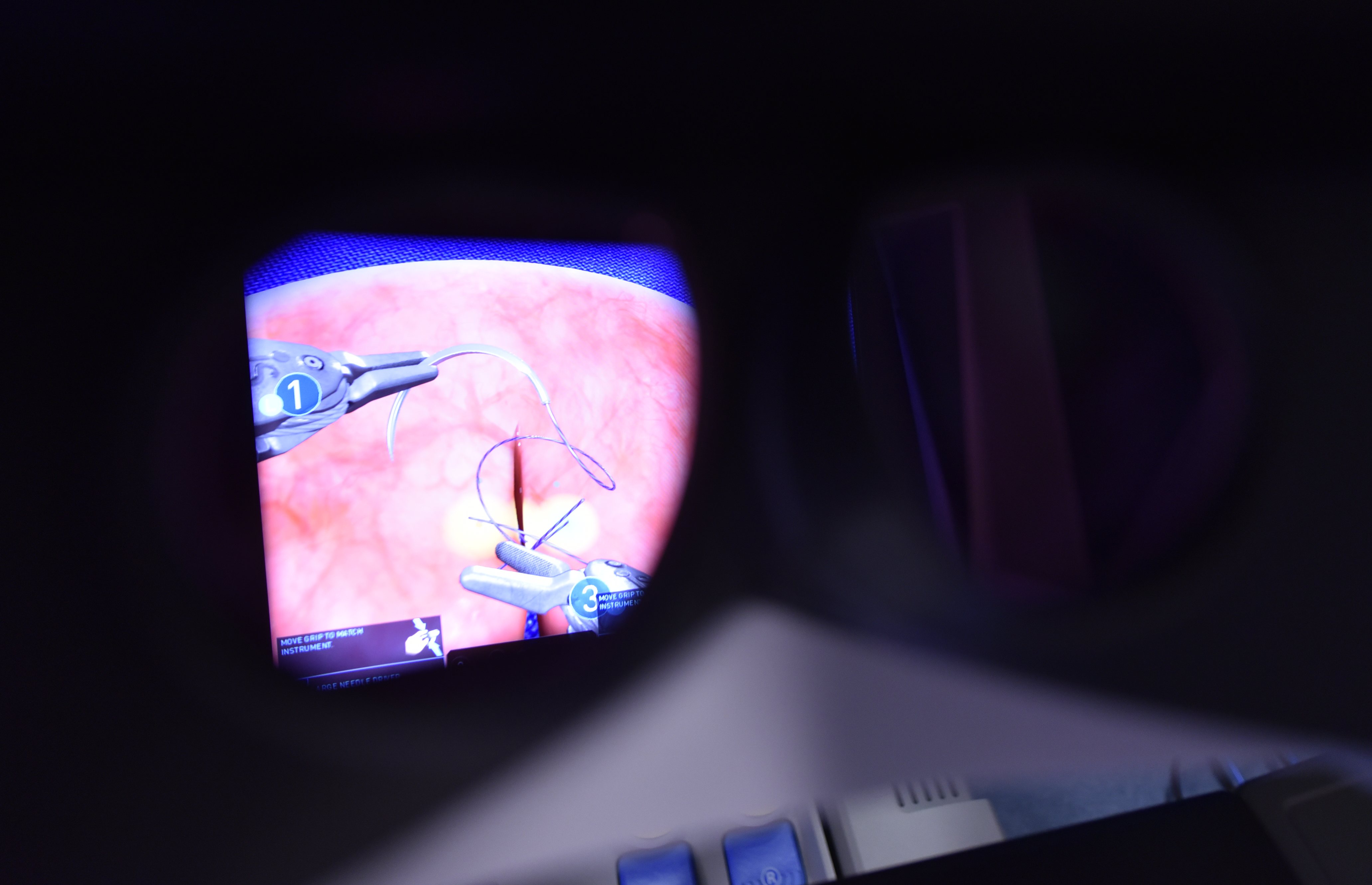 Prikaz operacije z robotom v UKC Ljubljana. Iz arhiva.