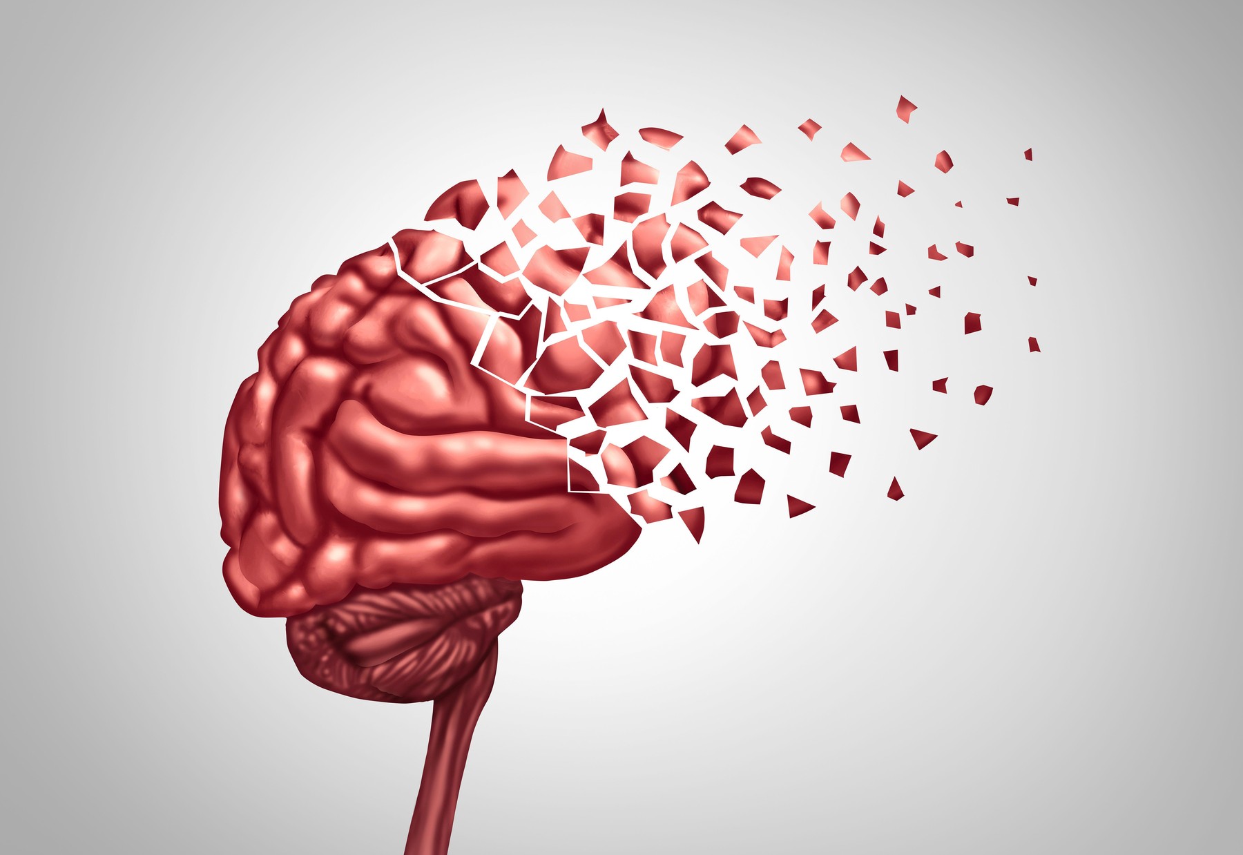 Huntingtonova bolezen