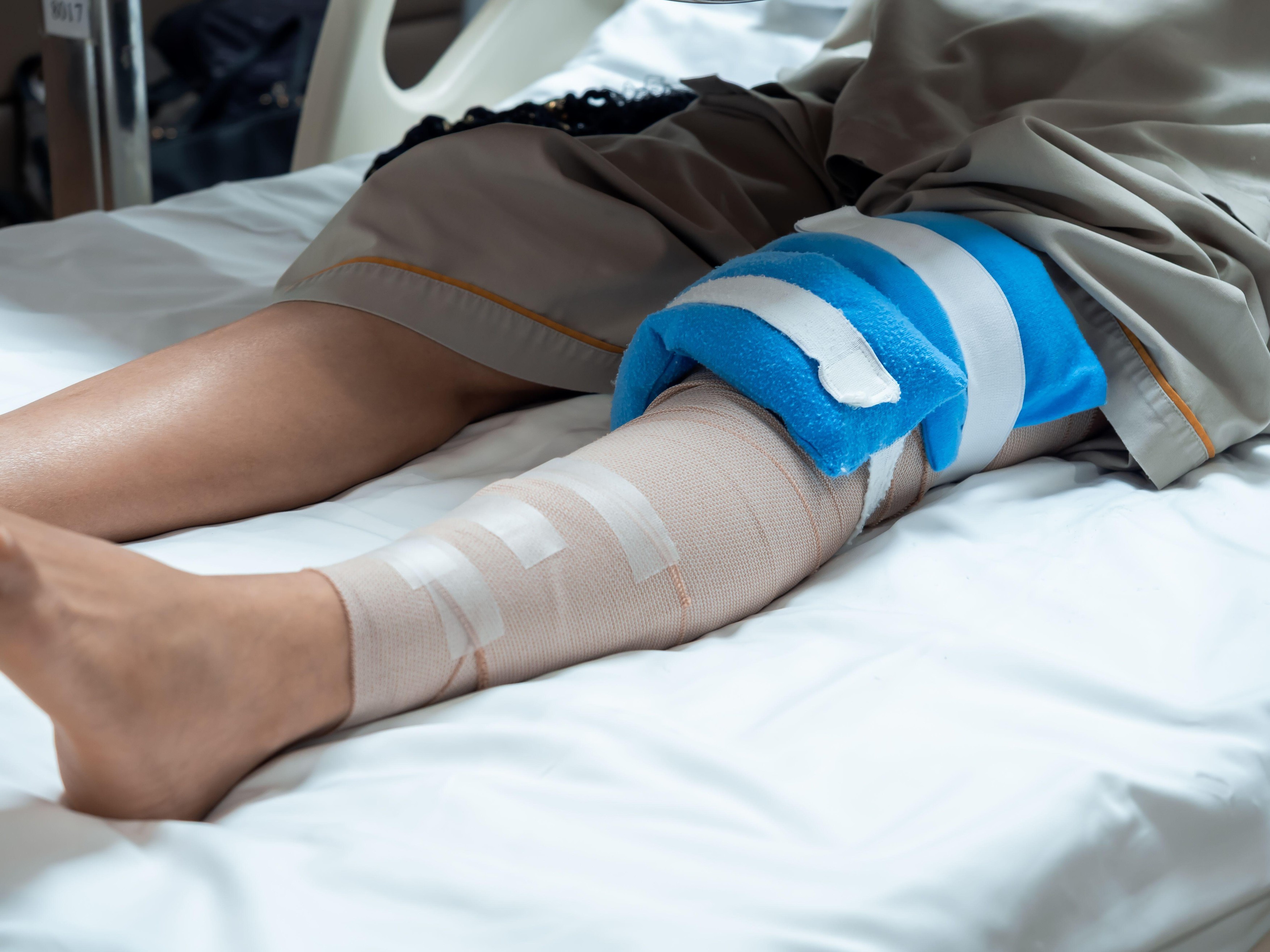 Close-up of injured leg with bandages and cold pack after ACL or meniscus knee surgery. Concept of post-operative recovery, pain relief, physical therapy, and orthopedic treatment in hospital care