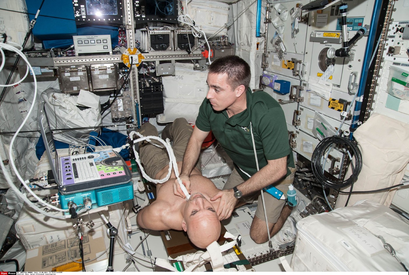 Uporaba ultrazvoka na MVP leta 2013: Nasin astronavt Chris Cassidy izvaja pregled na ESA astronavtu Luci Parmitano