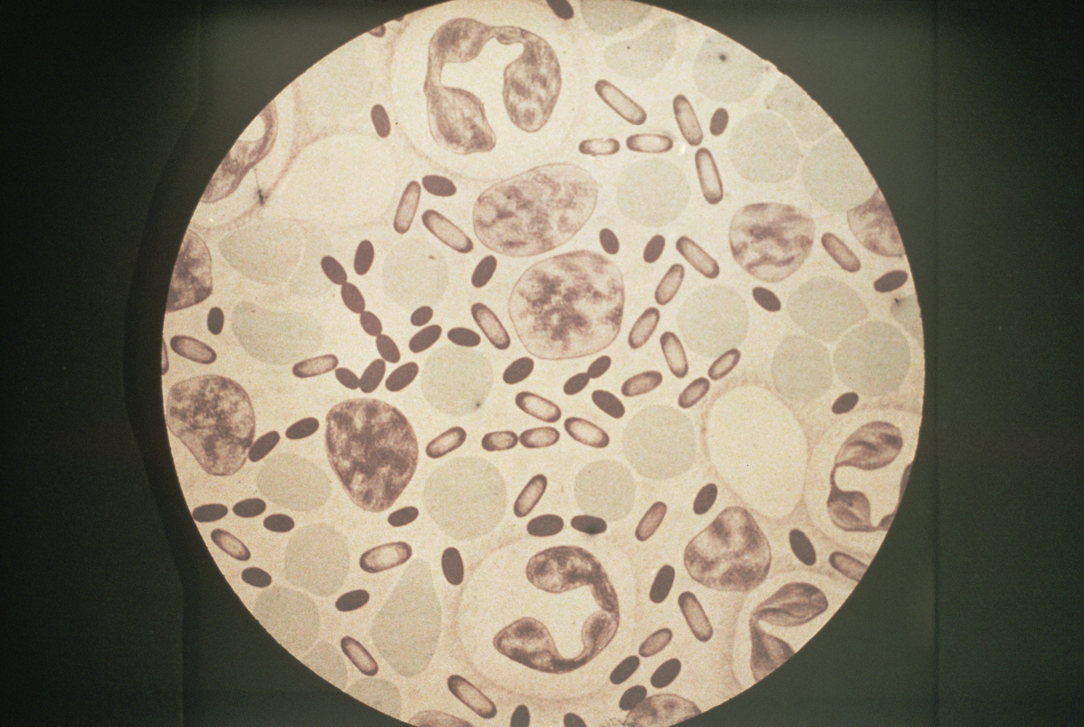 bakterija Yersinia pestis
