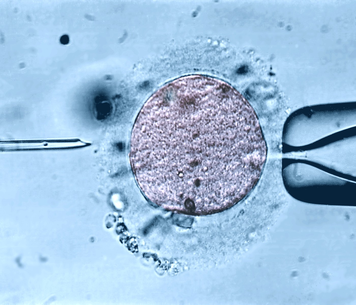 oploditev v epruveti, fertilizacija in vitro