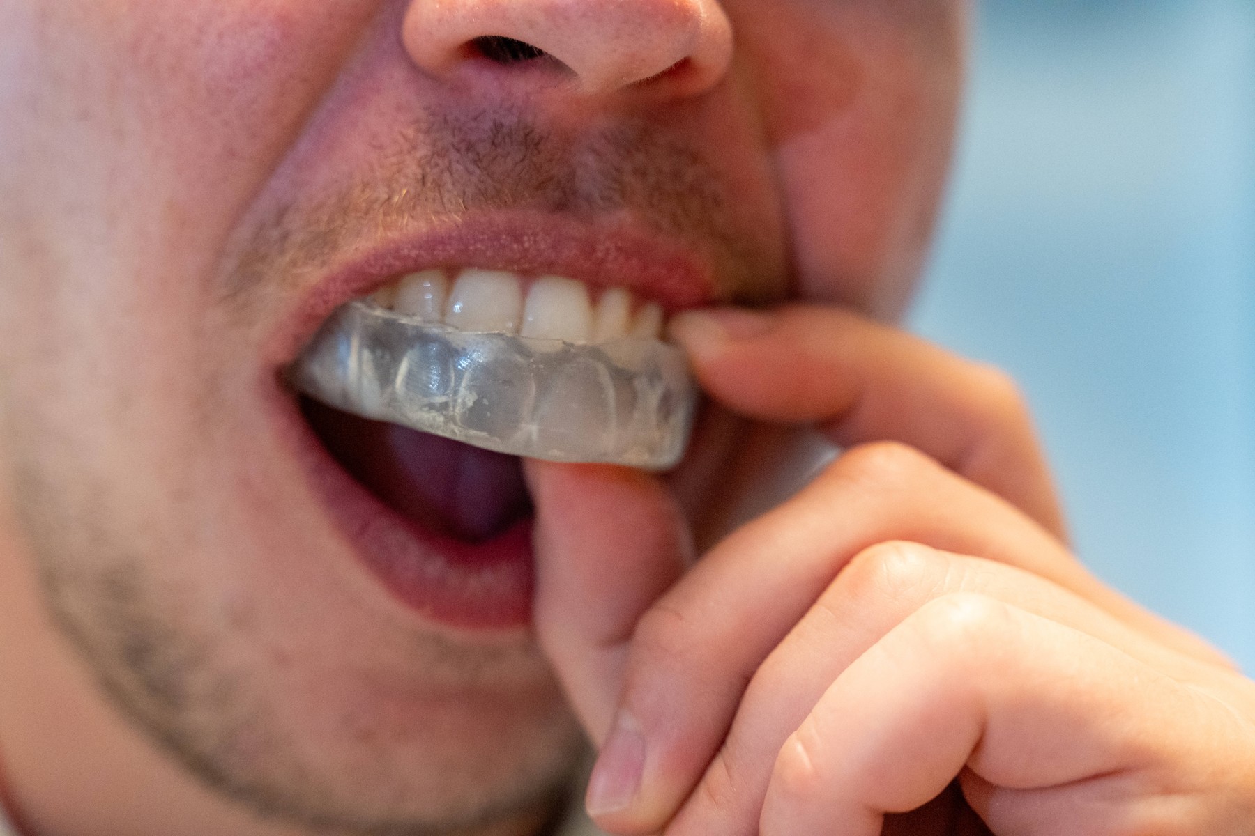 Nočna opornica za zaščito zob