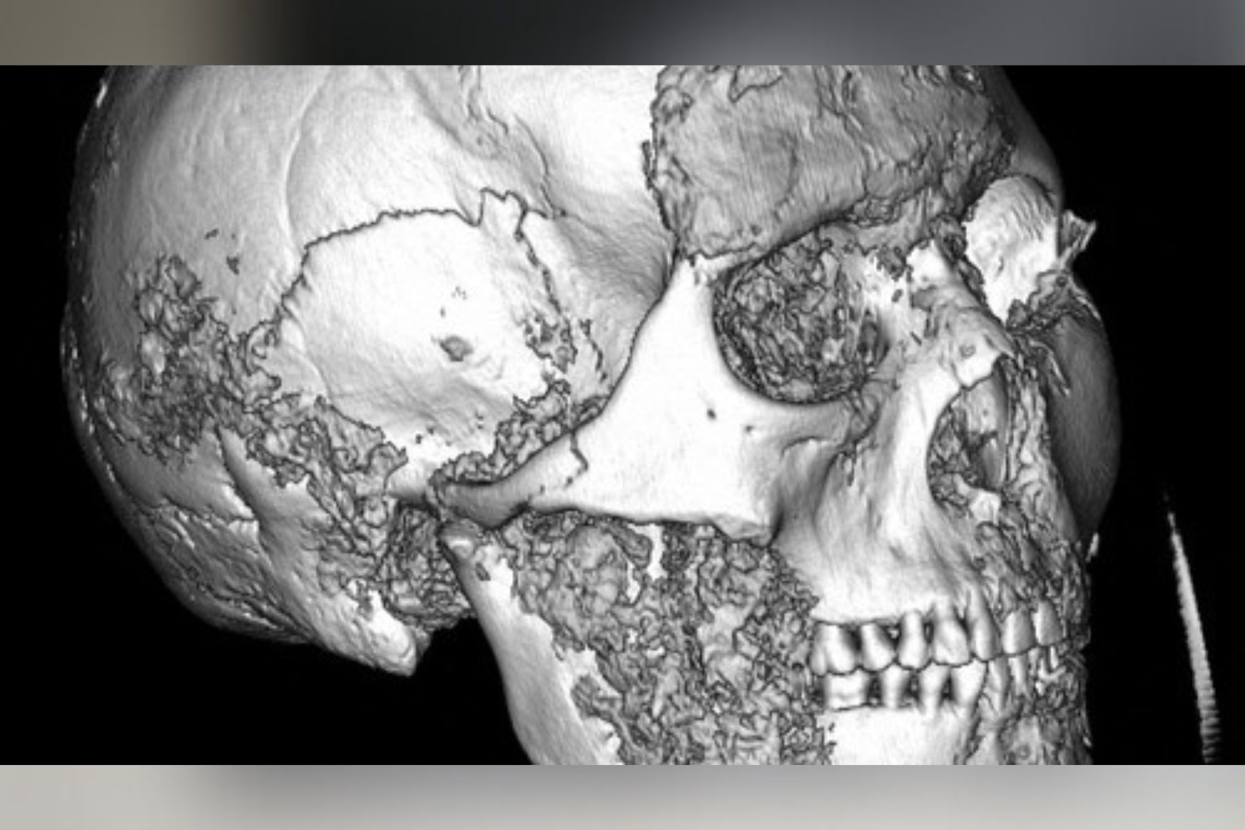 2.500 let stara lobanja