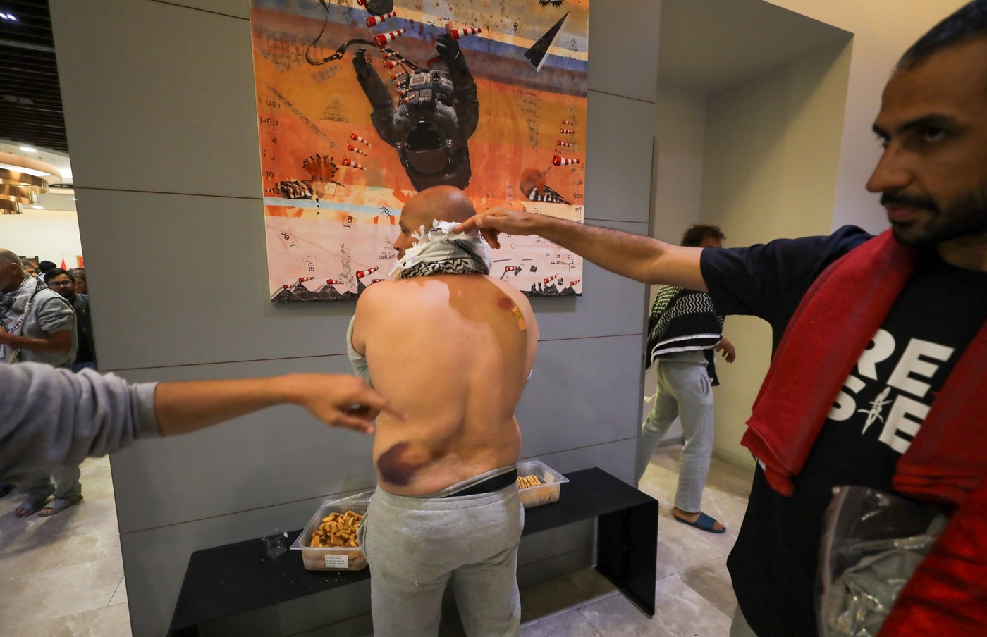Poškodovani aktivisti humanitarne flotilje za Gazo po vrnitvi iz Izraela
