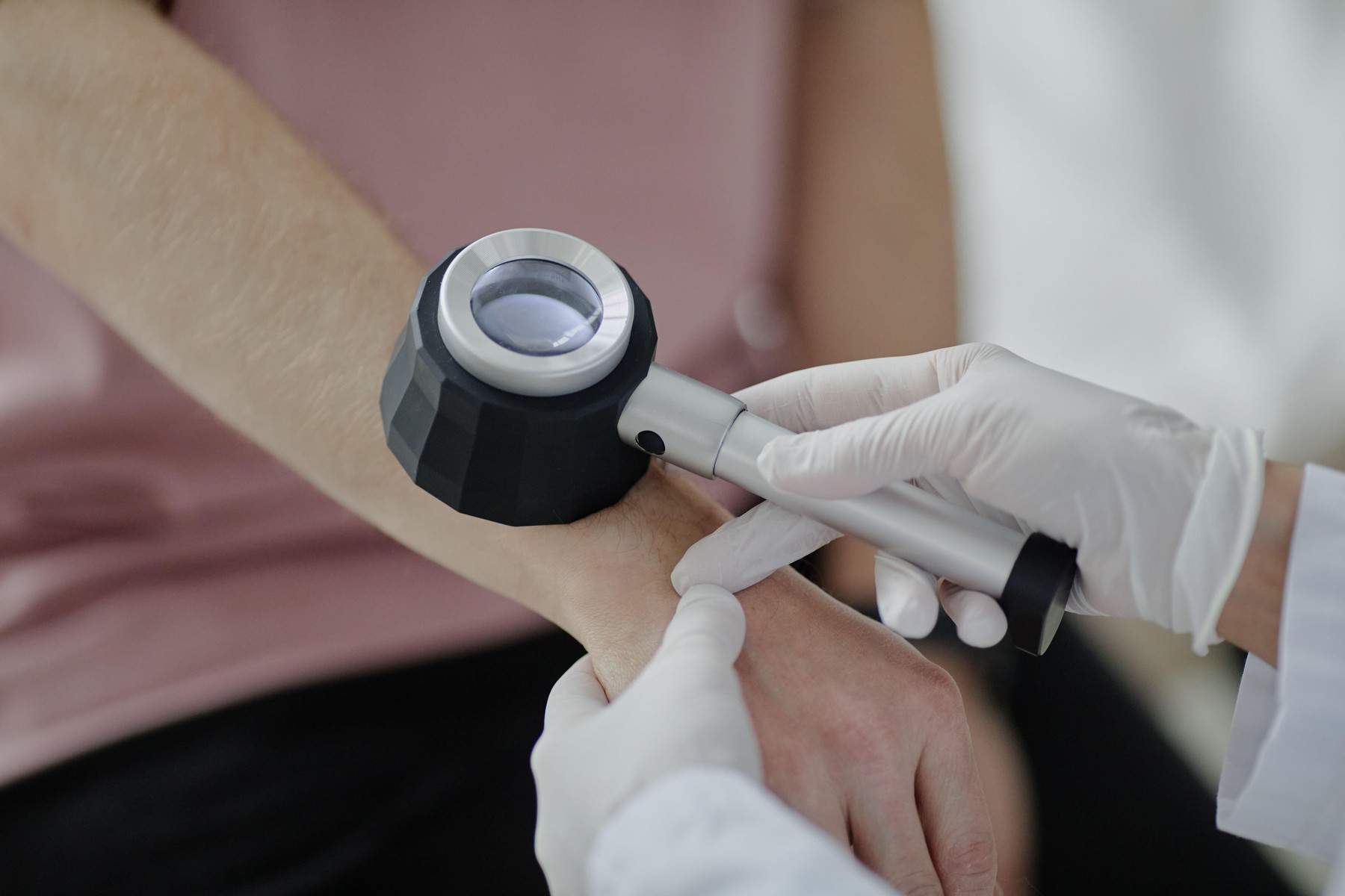 skin examination by dermatologist using dermatoscope