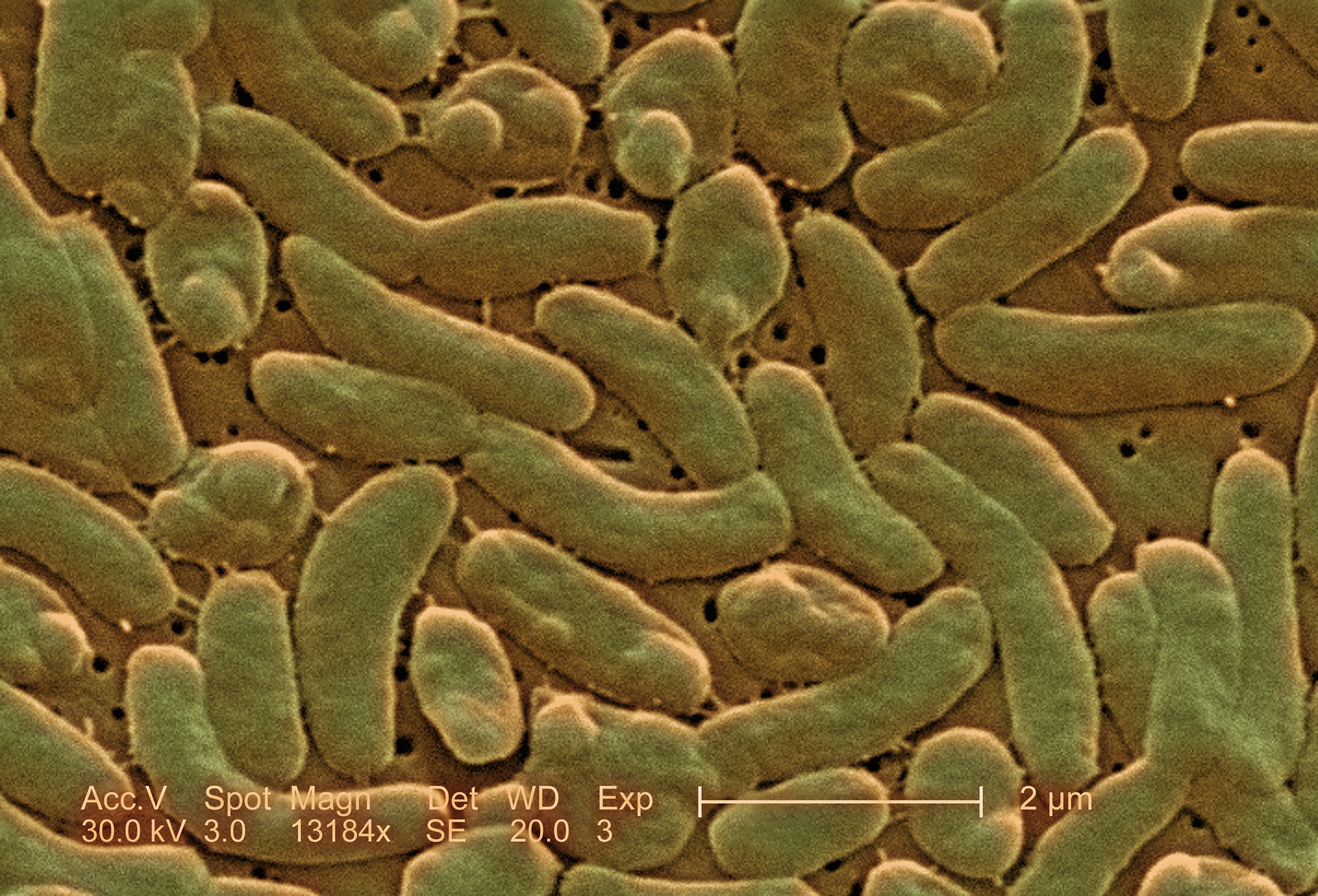 Vibrio vulnificus