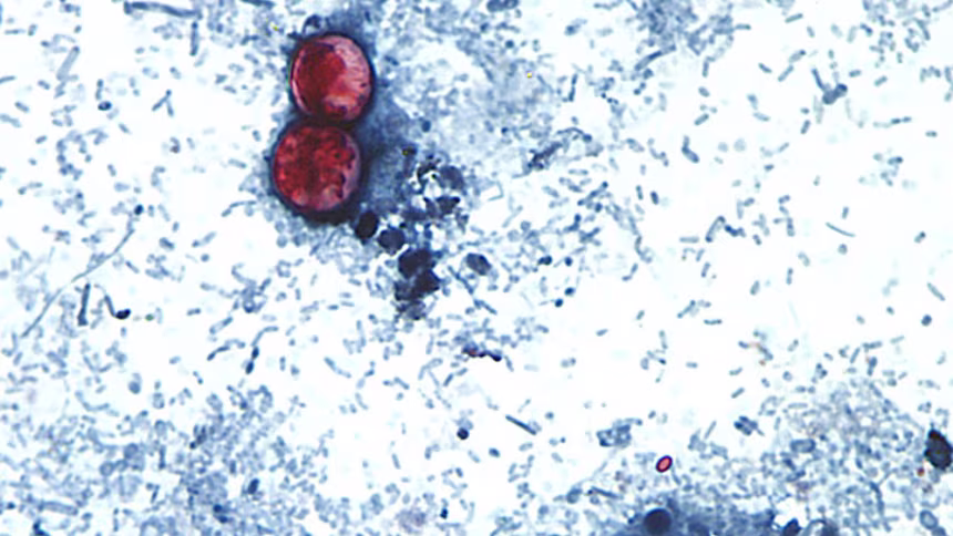 cyclosporiasis, ciklosporiaza pod mikroskopom