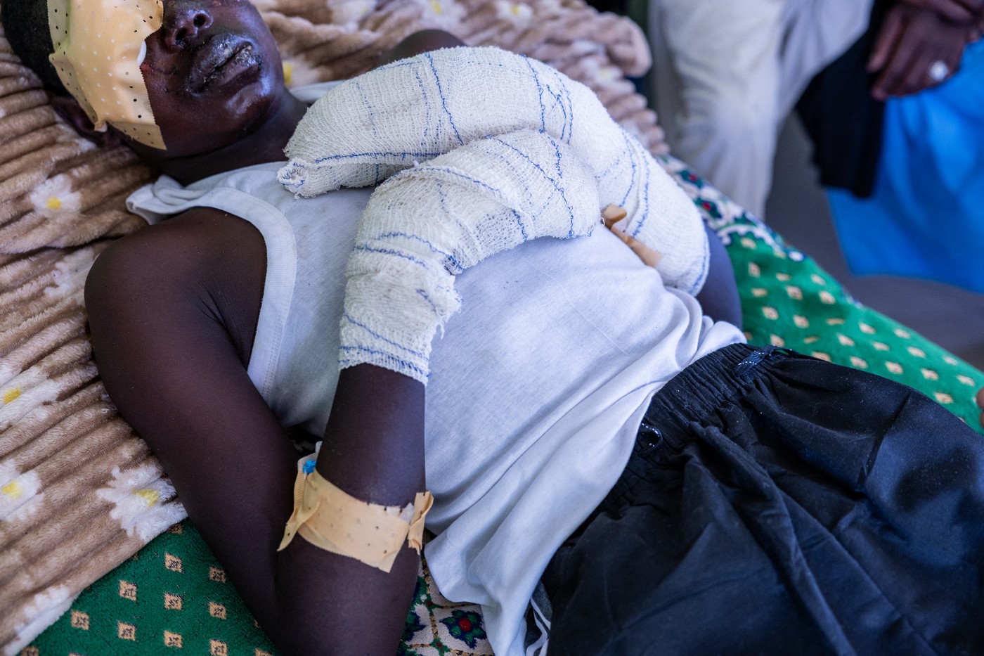Sudanski najstnik v bolnišnici v Čadu po napadu z dronom