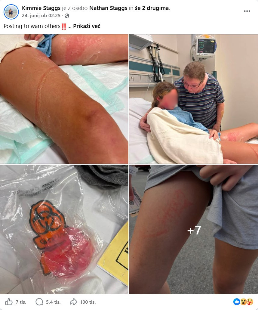Staggs je na družbenem omrežju Facebook tudi druge starše opozorila na nevarnost tovrstnih igrač, še posebej, če jih pustijo v vročem avtu.