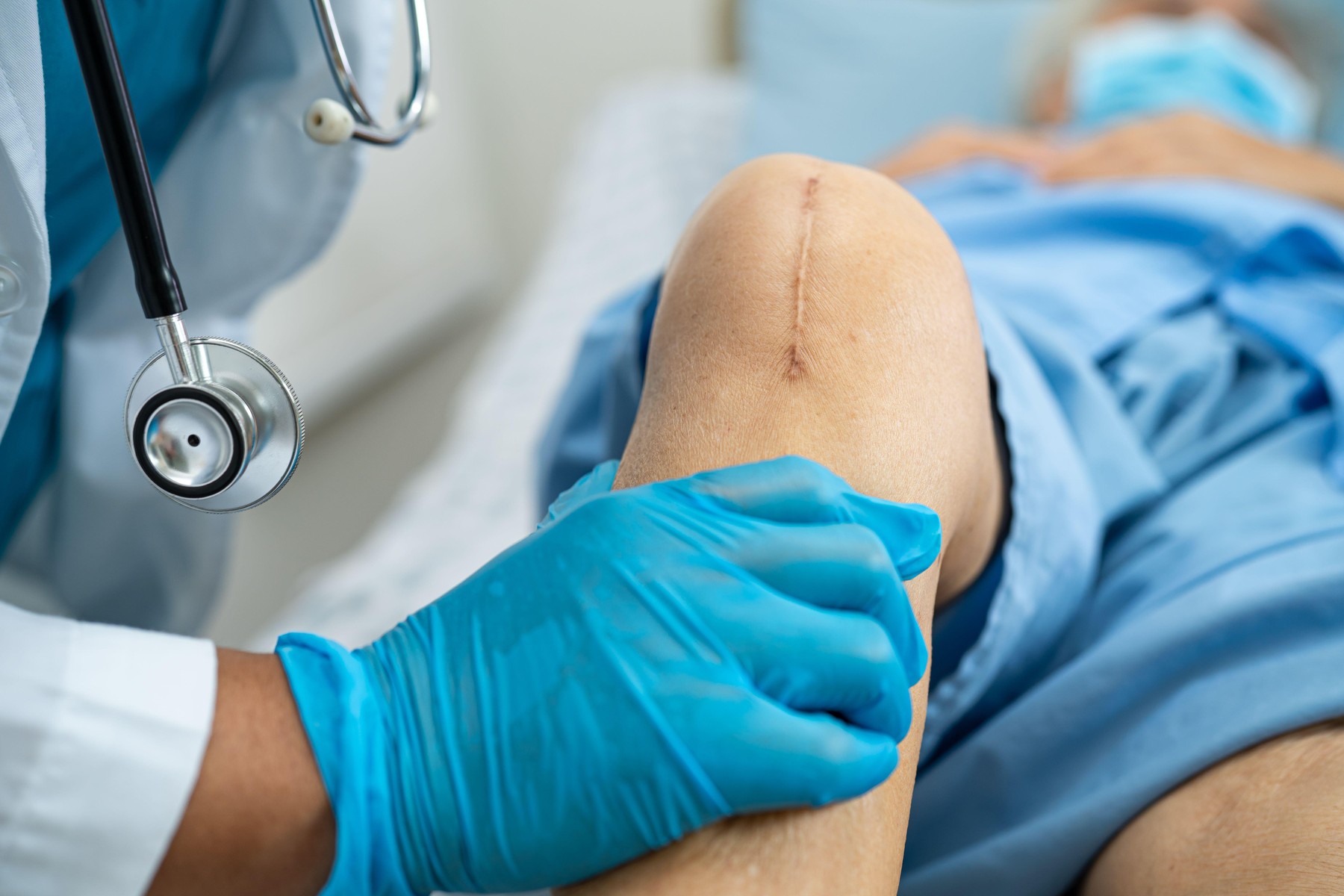 Asian senior or elderly old lady woman patient show her scars surgical total knee joint replacement Suture wound surgery arthroplasty on bed in nursing hospital ward