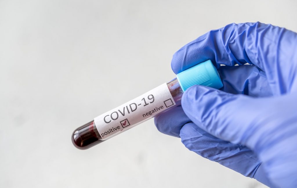 testiranje na okužbo s covidom-19