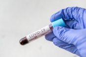 testiranje na okužbo s covidom-19