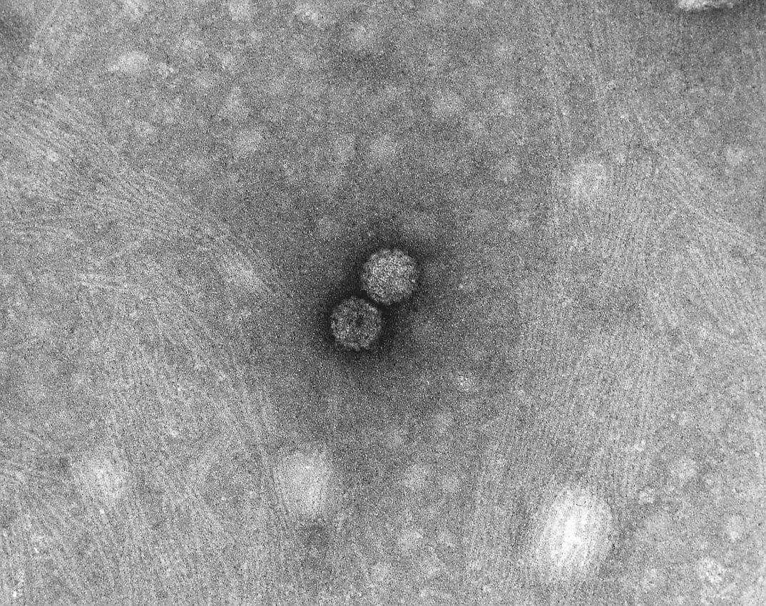 Papilomavirus