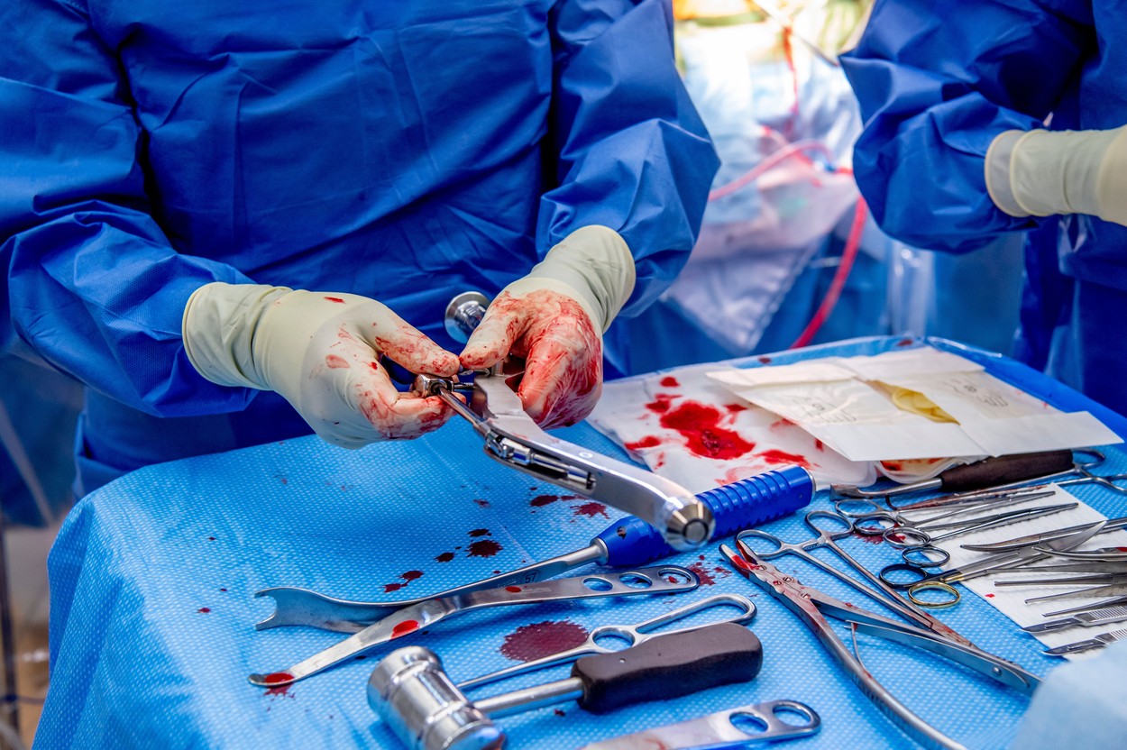 operacija, kirurg, kirurška miza