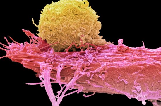 Terapija s celicami CAR-T, krvni rak