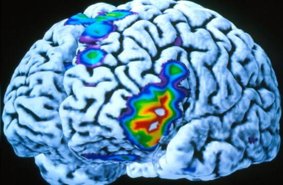 možgani, možganska aktivnost, MRI, PET, skeniranje