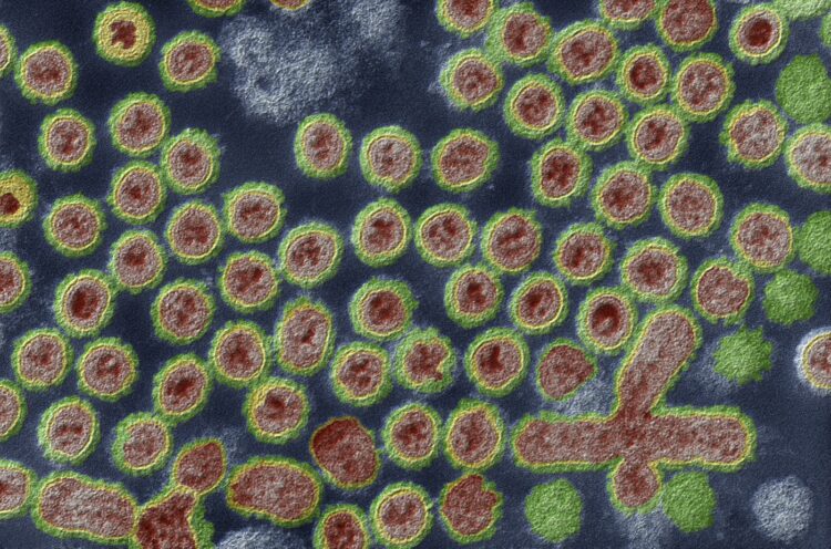 Virus ptičje gripe pod mikroskopom