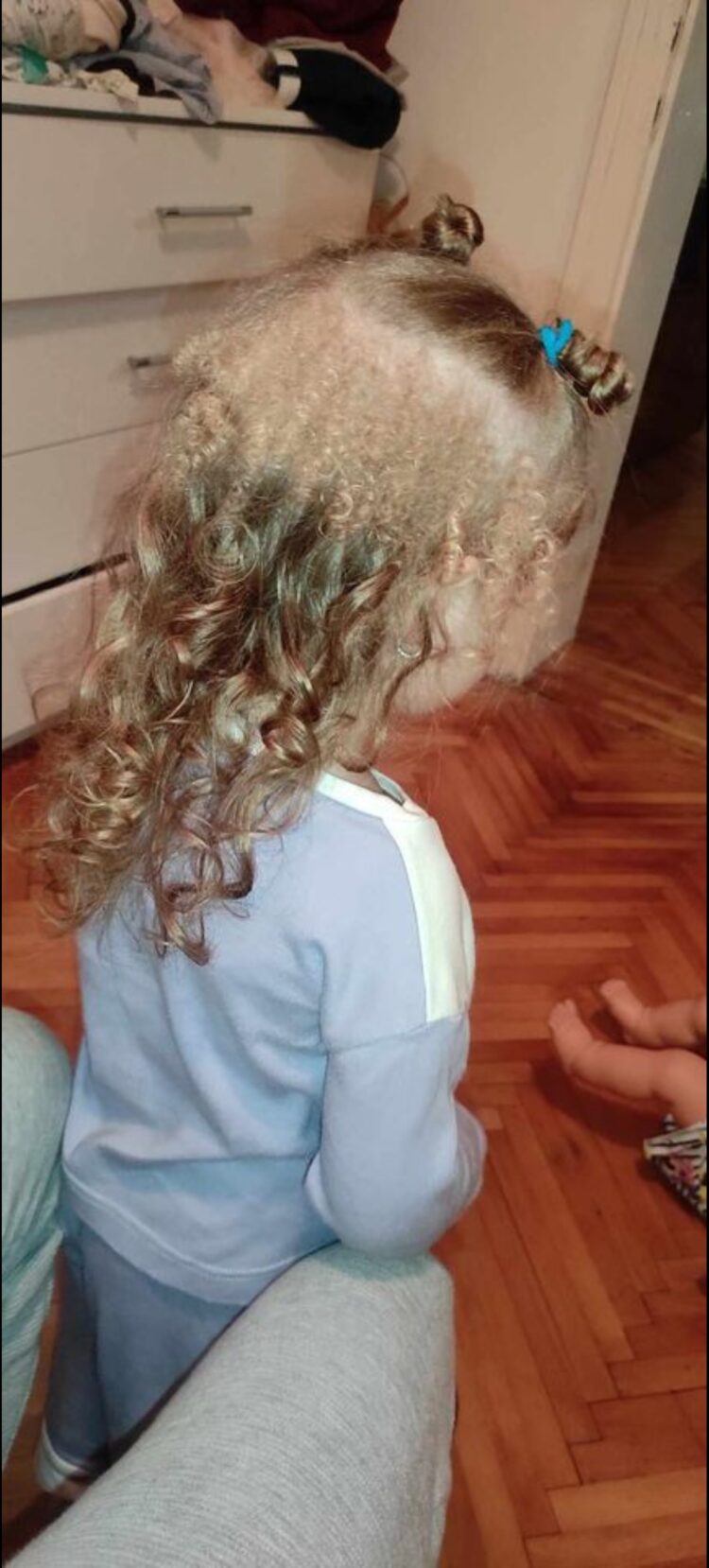 Srbska deklica ima tri vrste las