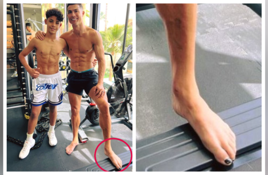 Zakaj ima Ronaldo črno pobarvane nohte na nogah? Za to ima dober razlog