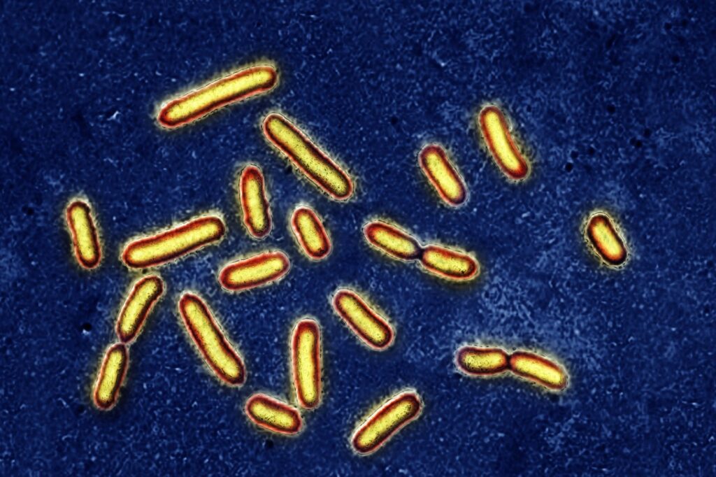 Pseudomonas aeruginosa